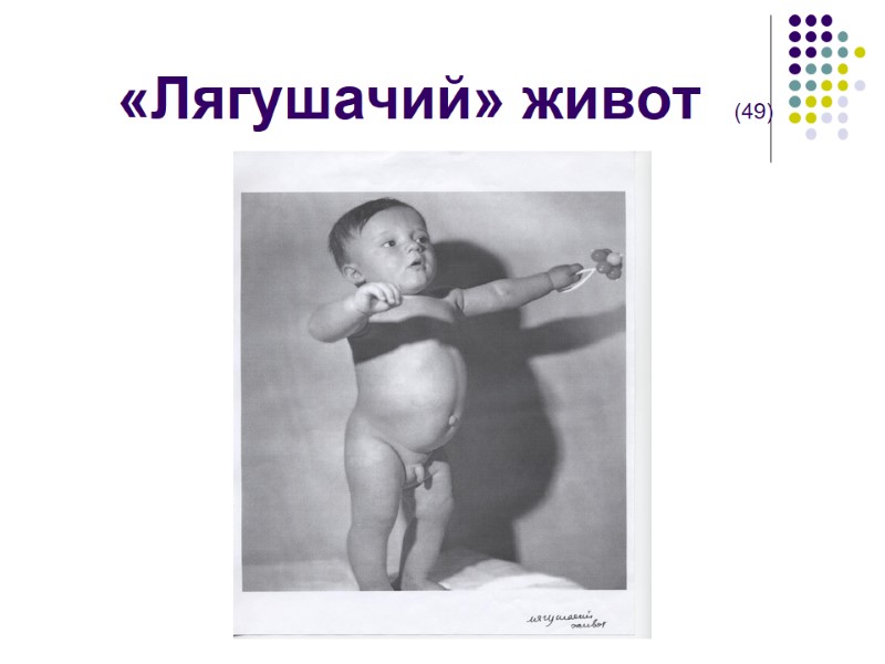 «Лягушачий» живот  (49)